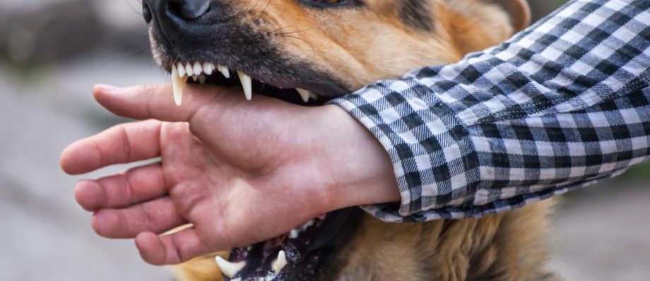 Dog Bites